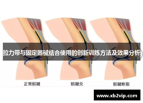拉力带与固定器械结合使用的创新训练方法及效果分析